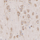 Immunohistochemical staining of human hippocampus shows moderate cytoplasmic positivity in neuronal cells.