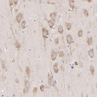 Immunohistochemical staining of human hippocampus shows moderate cytoplasmic positivity in neuronal cells.