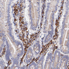 Immunohistochemical staining of human small intestine shows moderate cytoplasmic positivity in lymphoid cells.