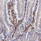 Immunohistochemical staining of human small intestine shows moderate cytoplasmic positivity in lymphoid cells.