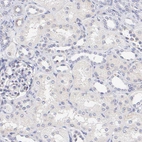 Immunohistochemical staining of human kidney shows no cytoplasmic positivit as expected.