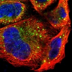 Immunofluorescent staining of human cell line A-431 shows localization to cytosol & vesicles.