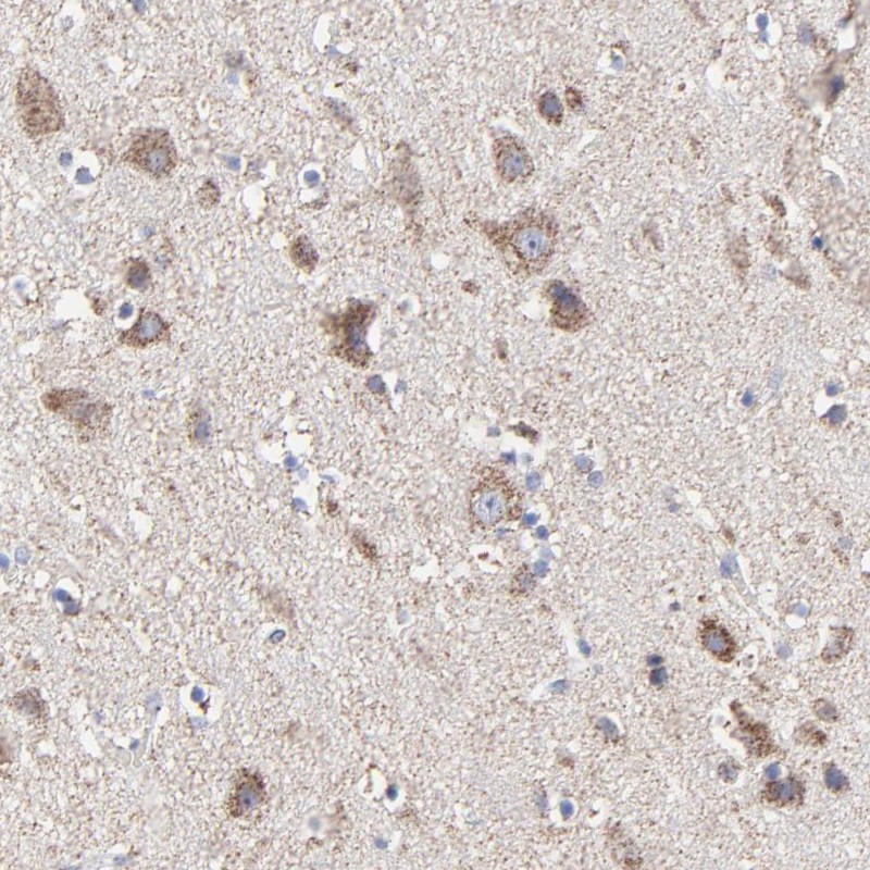 Anti-PINK1 Antibody