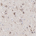 Anti-PINK1 Antibody