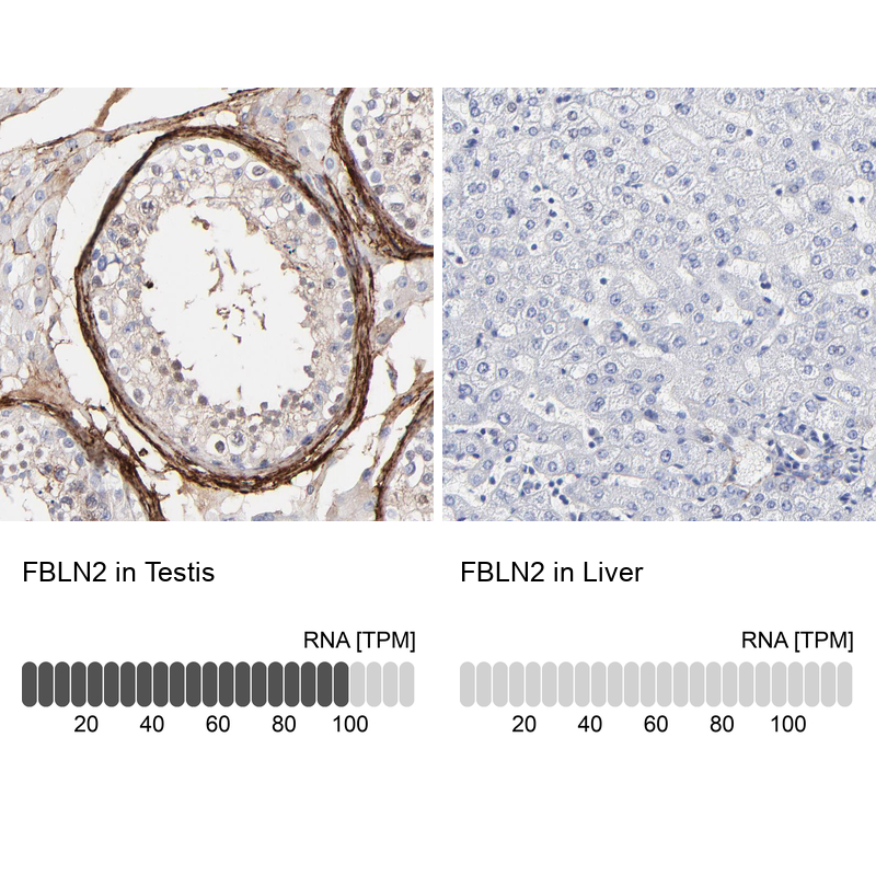 Anti-FBLN2 Antibody