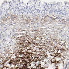 Immunohistochemical staining of human urinary bladder shows strong positivity in connective tissue.