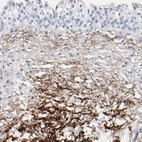 Immunohistochemical staining of human urinary bladder shows strong positivity in connective tissue.