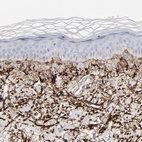 Anti-FBLN2 Antibody