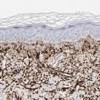 Immunohistochemical staining of human skin shows strong positivity in connective tissue.