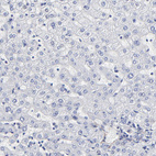 Immunohistochemical staining of human liver shows no positivity in hepatocytes as expected.