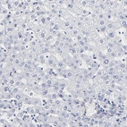 Immunohistochemical staining of human liver shows no positivity in hepatocytes as expected.
