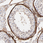 Anti-FBLN2 Antibody