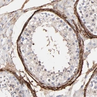 Immunohistochemical staining of human testis shows strong membranous positivity in peritubular myoid cells.