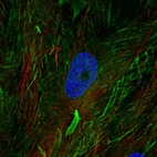 Immunofluorescent staining of human cell line BJ shows localization to plasma membrane.