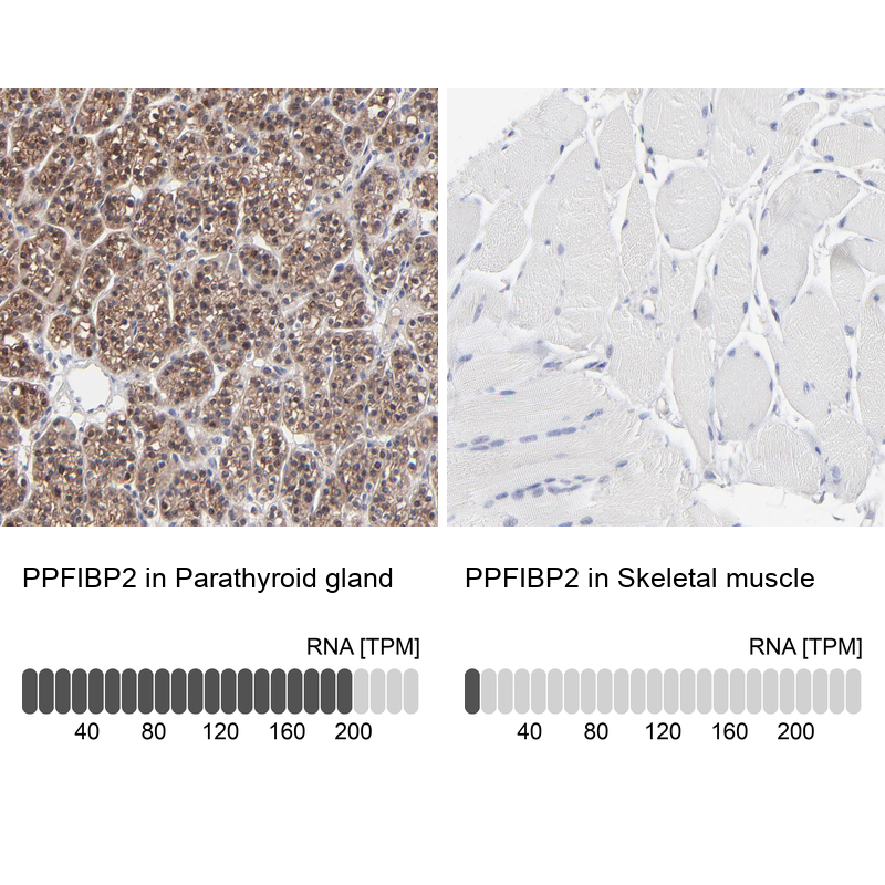 Anti-PPFIBP2 Antibody