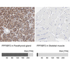 Anti-PPFIBP2 Antibody