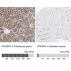 Anti-PPFIBP2 Antibody