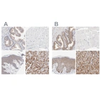 Immunohistochemical staining of human prostate, skeletal muscle, skin and stomach using Anti-PPFIBP2 antibody HPA001935 (A) shows similar protein distribution across tissues to independent antibody HPA003911 (B).