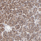 Anti-PPFIBP2 Antibody