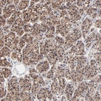 Immunohistochemical staining of human parathyroid gland shows strong cytoplasmic positivity in glandular cells.