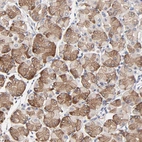 Immunohistochemical staining of human stomach shows moderate cytoplasmic positivity in glandular cells.