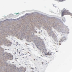 Immunohistochemical staining of human skin shows weak cytoplasmic positivity in squamous epithelial cells.