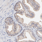 Anti-PPFIBP2 Antibody