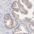 Immunohistochemical staining of human prostate shows weak cytoplasmic positivity in glandular cells.