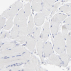 Immunohistochemical staining of human skeletal muscle shows no positivity in myocytes as expected.