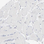 Immunohistochemical staining of human skeletal muscle shows no positivity in myocytes as expected.