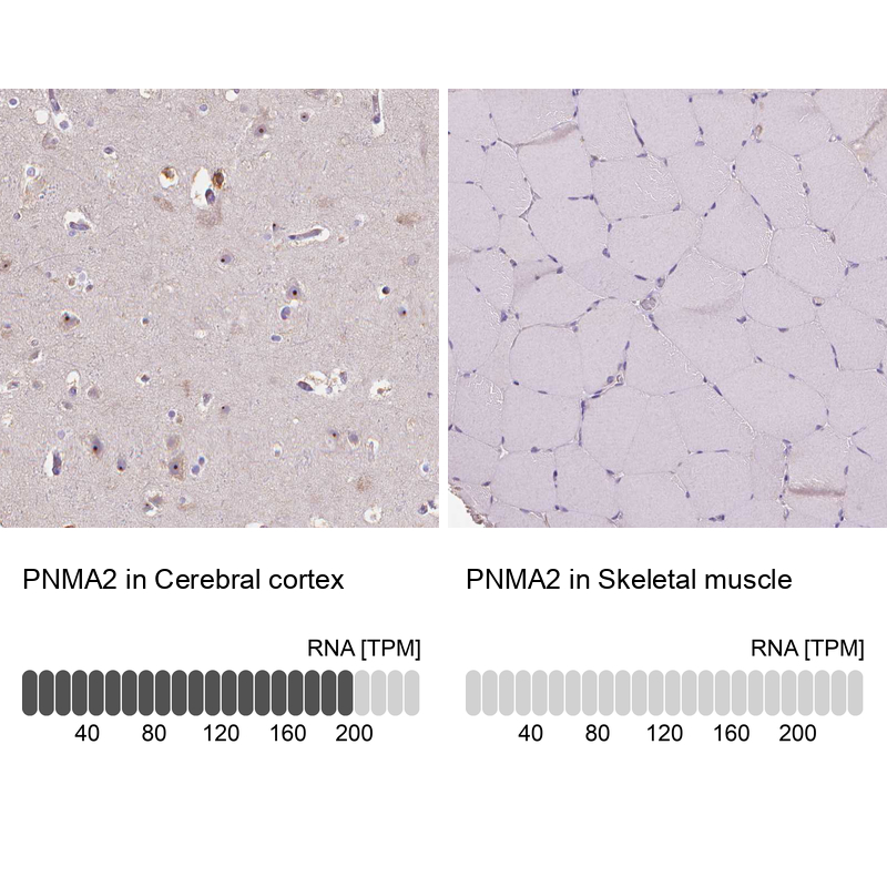Anti-PNMA2 Antibody