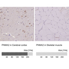 Anti-PNMA2 Antibody