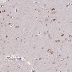 Immunohistochemical staining of human cerebral cortex shows strong nucleoli positivity in neuronal cells.