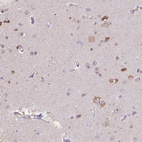 Anti-PNMA2 Antibody