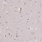Immunohistochemical staining of human cerebral cortex shows moderate nucleolar positivity in neurons.