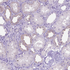 Immunohistochemical staining of human kidney shows moderate cytoplasmic positivity in cells in distal tubules.