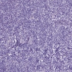 Immunohistochemical staining of human tonsil shows no positivity in non-germinal center cells, as expected.