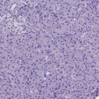Immunohistochemical staining of human pancreas shows no positivity in exocrine glandular cells as expected.