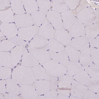 Immunohistochemical staining of human skeletal muscle shows negative cytoplasmic positivity in myocytes as expected.