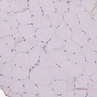 Immunohistochemical staining of human skeletal muscle shows no positivity in myocytes as expected.
