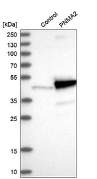 Western blot analysis in control (vector only transfected HEK293T lysate) and PNMA2 over-expression lysate (Co-expressed with a C-terminal myc-DDK tag (~3.1 kDa) in mammalian HEK293T cells, LY416096).