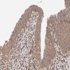 Anti-MMP2 Antibody