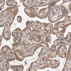 Anti-MMP2 Antibody