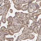 Immunohistochemical staining of human placenta shows weak to moderate cytoplasmic positivity in trophoblastic cells.