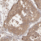 Anti-MMP2 Antibody