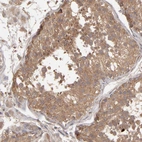 Immunohistochemical staining of human testis shows weak to moderate cytoplasmic positivity in cells in seminiferous ducts.