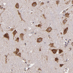 Anti-USP51 Antibody