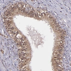 Immunohistochemical staining of human epididymis shows moderate cytoplasmic positivity in glandular cells.