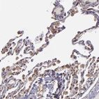 Immunohistochemical staining of human lung shows moderate cytoplasmic and nuclear positivity in pneumocytes.