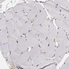 Immunohistochemical staining of human skeletal muscle shows no positivity in myocytes as expected.
